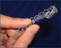 Invisalign 001