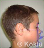 Profil Fotoaufnahme bei Dr Kölklü