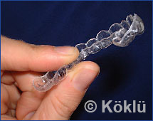 Clear Aligner Invisalign Alternative