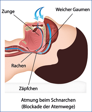 schnarchen 01