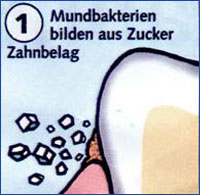 Entstehung Zahnbelag